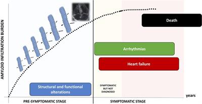 Risk stratification in transthyretin-related cardiac amyloidosis